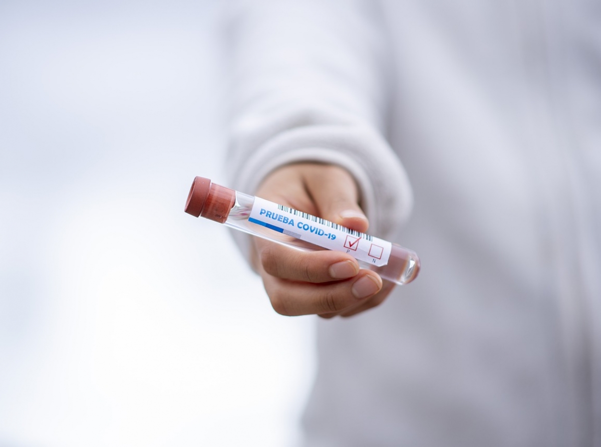 Δωρεάν Rapid Tests στο Δήμο Τεμπών